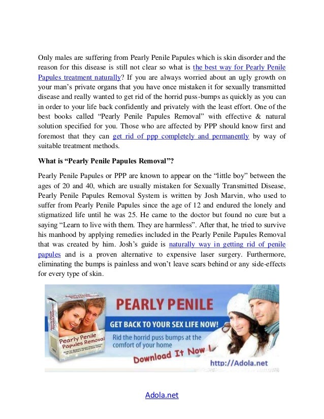 Penile Papules How Of Naturally Get To Rid Pearly Penile Papules How Of Naturally Get To Rid Pearly
